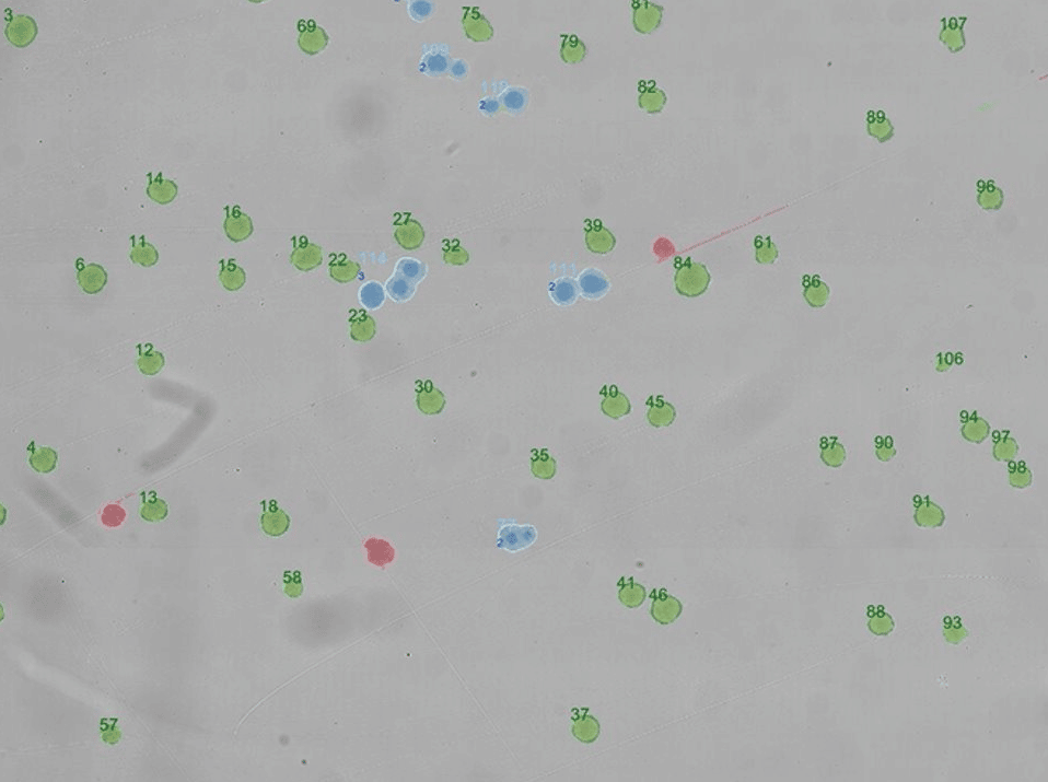 Visualization of automated tracking of colonies on agar