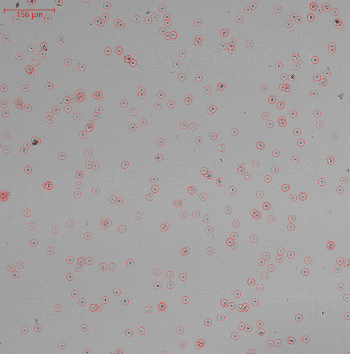 Image of algorithmically automatic counted fungal cells