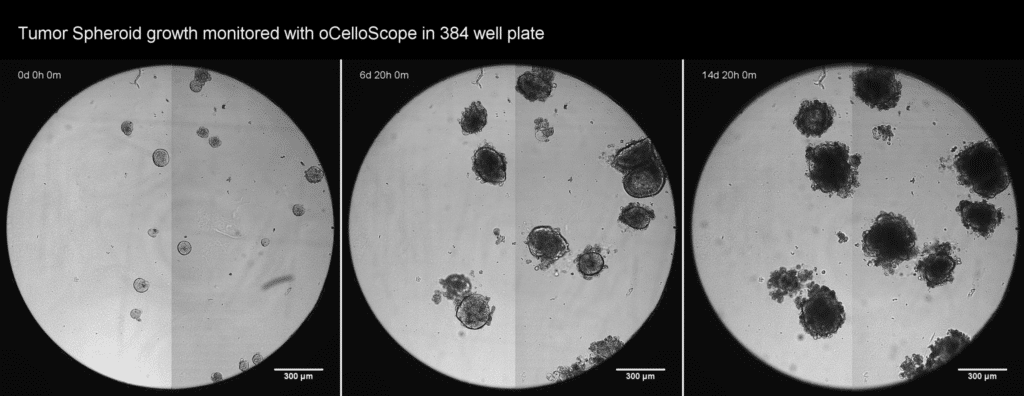 Tumor Spheroid growth monitored with oCelloScope in 384 well plate